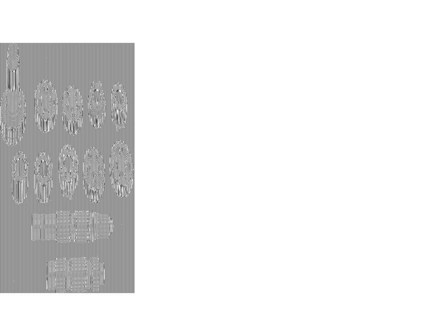 Harley Davidson Sportster [1991-2003] – ENGES VERHÄLTNIS 1. GANG SET 5-Gang